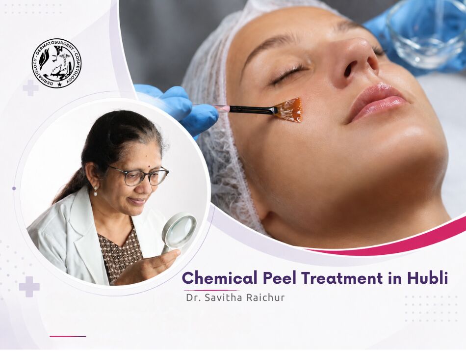 Chemical Peel Treatment in Hubli Explained by a Dermatologist for Acne Marks and Pigmentation